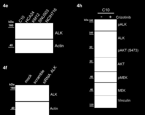Supplementary Figure 9. Full lengths western blot of Figure 4. (4e) C10 CRC cells overexpress ALK protein.