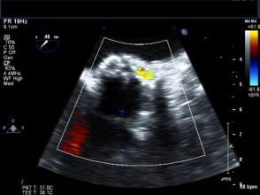 evaluation Echocardiogram CTA Cardiac
