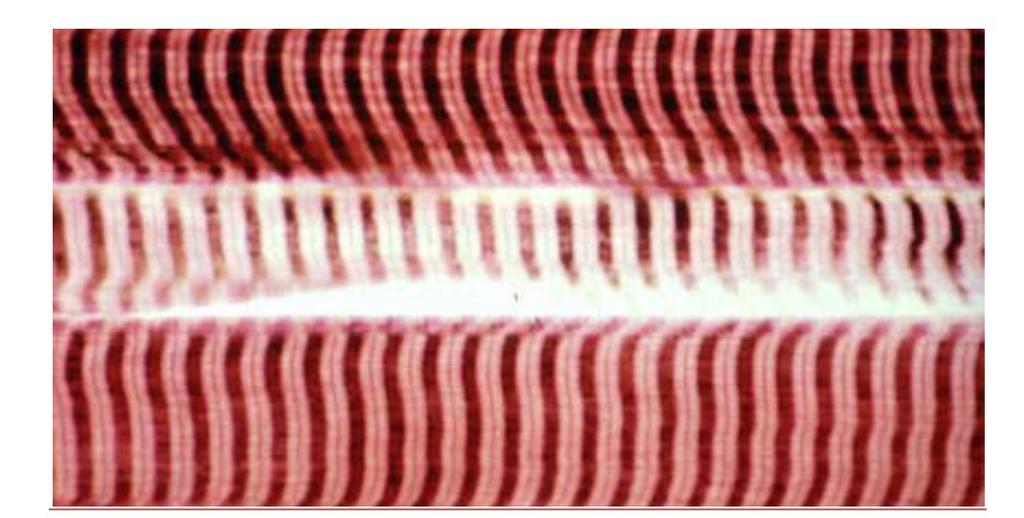 Model 9 Muscle fiber through the microscope 30. When viewing skeletal muscle through a microscope, you can easily see dark and light striations of the muscle fiber.
