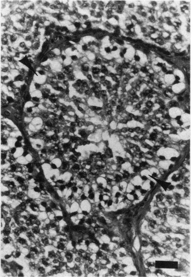 Spermatocyte swelling and intracytoplasmic vacuolation of Sertoli's cells are seen in most rabbits. Affected spermatocytes have clear cytoplasm and eccentric, often pyknotic, nuclei (Fig. 4).