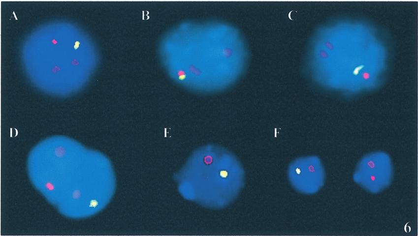 M.Sousa et al. Figure 6. Fluorescent in-situ hybridization analysis of isolated early germ cells using probes to chromosomes X (yellow), Y (red) and 18 (violet).