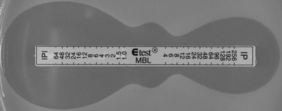 IP or IPI ellipse is indicative of MBL