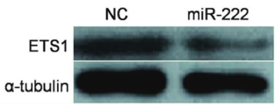 Detection of ETS1 protein expression by Western blot.
