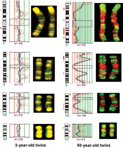 Epigenetic differences arise during the lifetime of monozygotic twins Mapping chromosomal regions with differential DNA methylation in MZ twins Green and red signals indicate hypermethylation