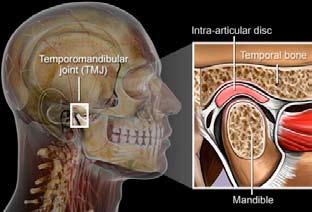 What is the TMJ? The jaw is also known as the TMJ or Temporomandibular Joint. It can be painful as the result of injury, inflammatory disease, poor postures and habits or growth disorders.