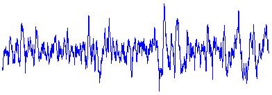 Also, slow eye movements in EOG and vertex sharp waves in EEG can be other indicators for that stage.