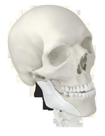Facial id - Reconstruction and augmentation CT# Description 54440110 MEDPOR patient specific