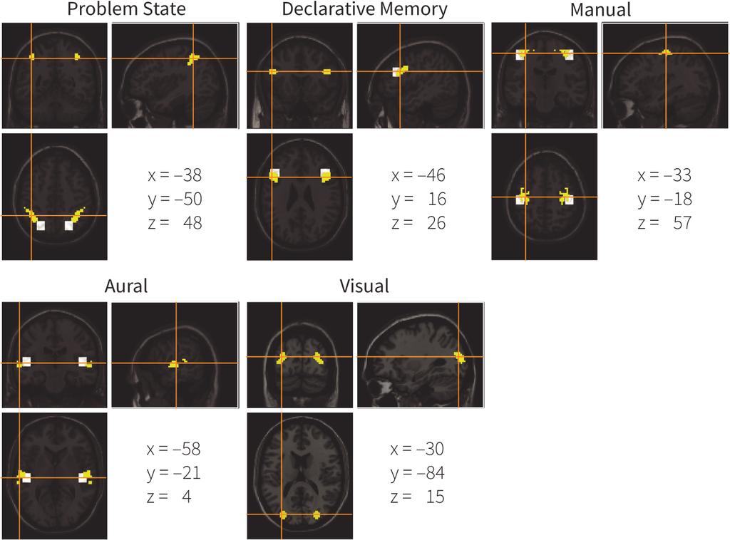 Fig 4. The new mapping of ACT-R modules to brain regions.