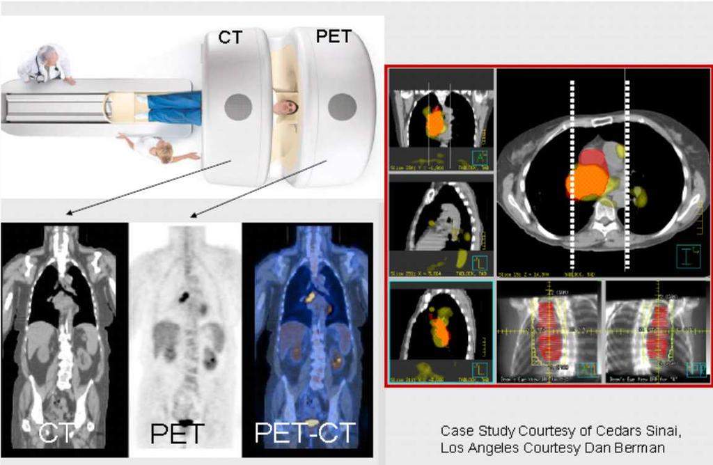 CT PET SPECT Fusion 3-D CT data