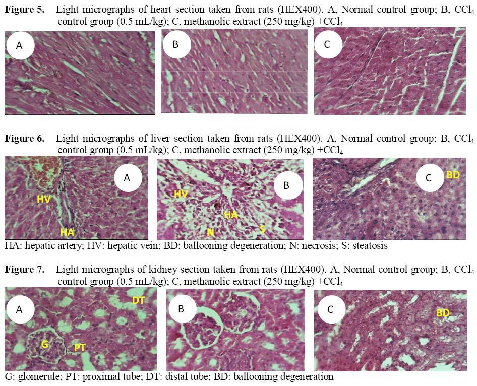 Estimation of lipid peroxidation MDA concentration was about 2.34, 1.95 and 2.52 mmol/mg of tissue in heart, liver and kidney of in control rats.