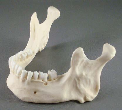 Dentition: The skull exhibits full adult dentition with the exception of all four 3 rd molars.