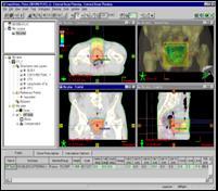 Excellence in proton therapy : integration TPS/OIS: