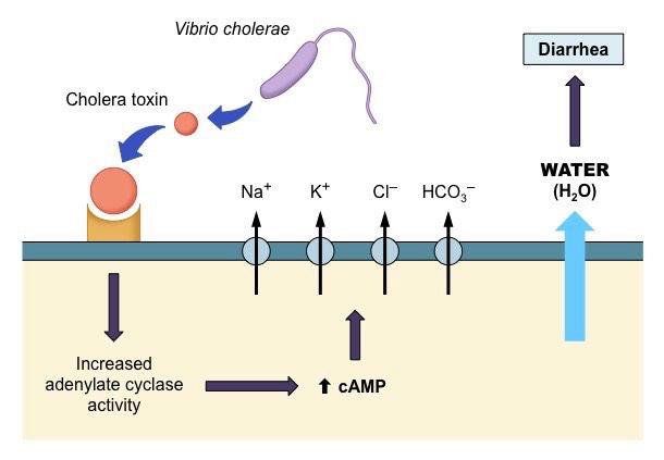 D.2.A2 Dehydration due to cholera toxin. Vibrio cholerae is a bacterial pathogen that infects the intestines and causes acute diarrhoea and dehydration.