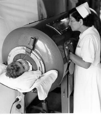 Negative-Pressure Ventilators - Early negative-pressure ventilators were known as iron lungs.