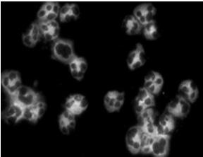 C ANCA. Cytoplasmic granular centrally accentuated Imm.fluoroscent pattern PR3 P ANCA.