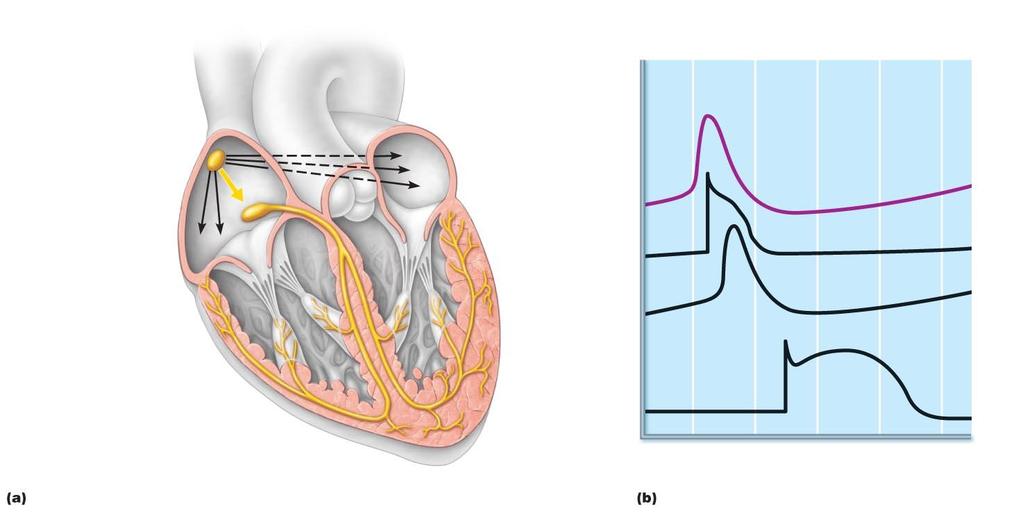 Figure 18.15 Intrinsic cardiac conduction system and action potential succession during one heartbeat. Superior vena cava ight atrium 1 he sinoatrial (SA) node (pacemaker) generates impulses.