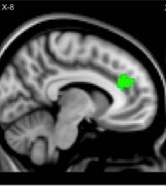 Deep brain stimulation restores frontostriatal network activity in
