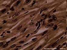 Cardiomyocytes Heart muscle consists of three types of cells: 1) Fast cells of working myocardium that make a contraction as a response to electric signal created in pacemaker cells most