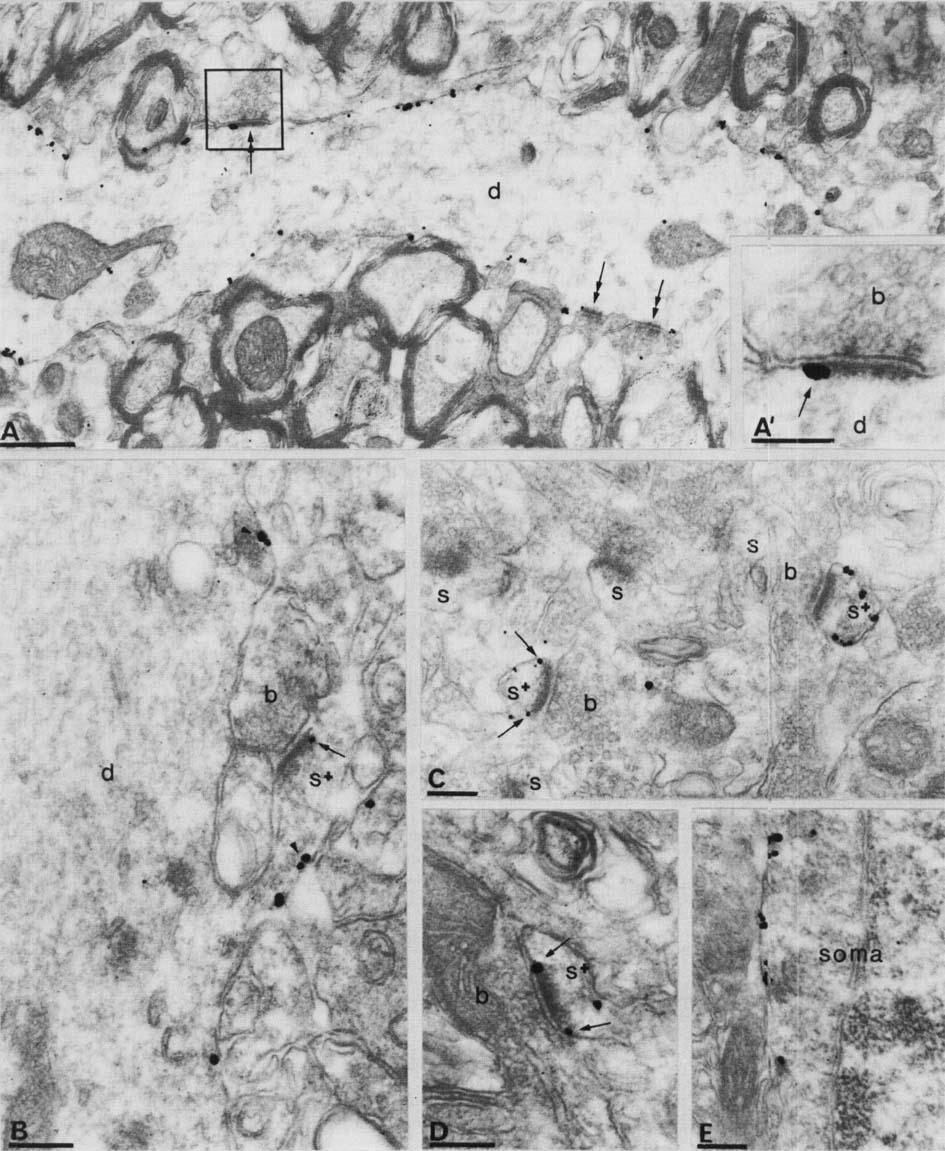 1492 Perisynaptic mglurs in rat hippocampus FIG. 2. Electron micrographs of the CAI region showing immunoreactivity for mglur5 as demonstrated by a pre-embedding immunogold method.