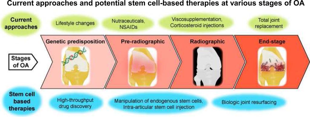 Diekman and Guilak Page 13 Figure 2. Current approaches and potential stem cell-based therapies at various stages of OA Treatments for OA vary with the stage of the disease.