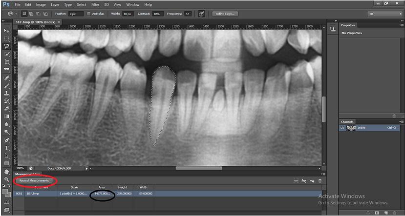 For Measuring the Area of the Tooth And Pulp When the desired image is opened (here, 18F from the sample folder), click on the magnetic lasso tool from the toolbar 9 (Figure 22).