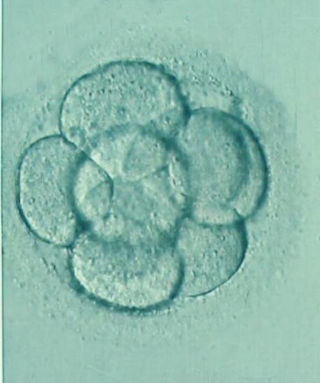 IVF/ ICSI outcomes of fresh v/s frozen thawed embryos Better IVF outcomes when performing elective Frozen Embryo Transfer (FET) All embryos frozen, hence they are not the second best embryos frozen