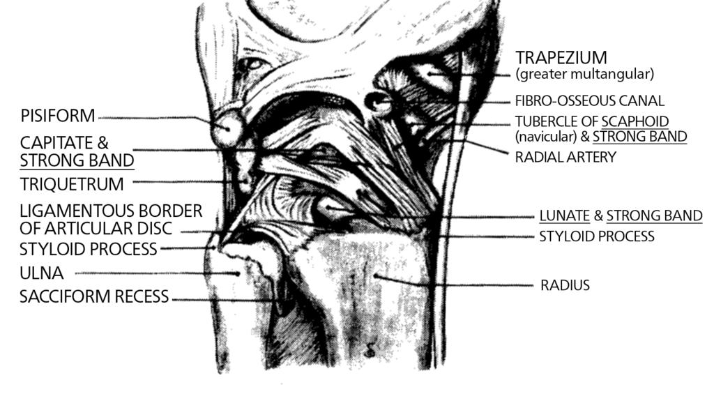 FIGURE 1D Complete resection of the carpal bone (trapezium, scaphoid, or lunate) may leave holes in the palmar ligaments as illustrated.