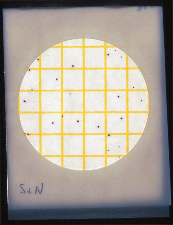 Use an illuminated magnifier so that the colonies are easier to see. The test is complete. 4 5 S.