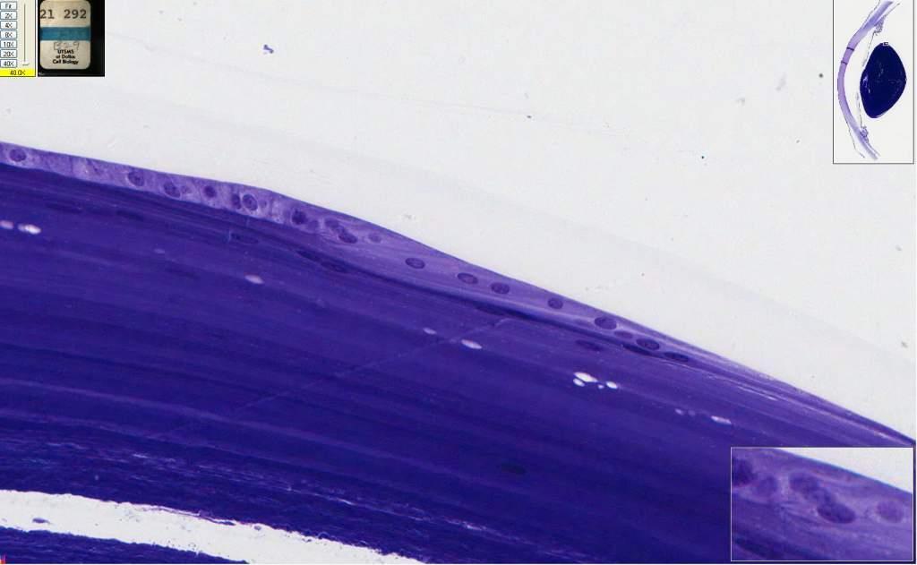 292 Eye (toluidine blue) elongation of lens cuboidal cells at bow region Capsule Lens cuboidal