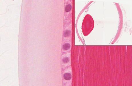 epithelium on the anterior surface of