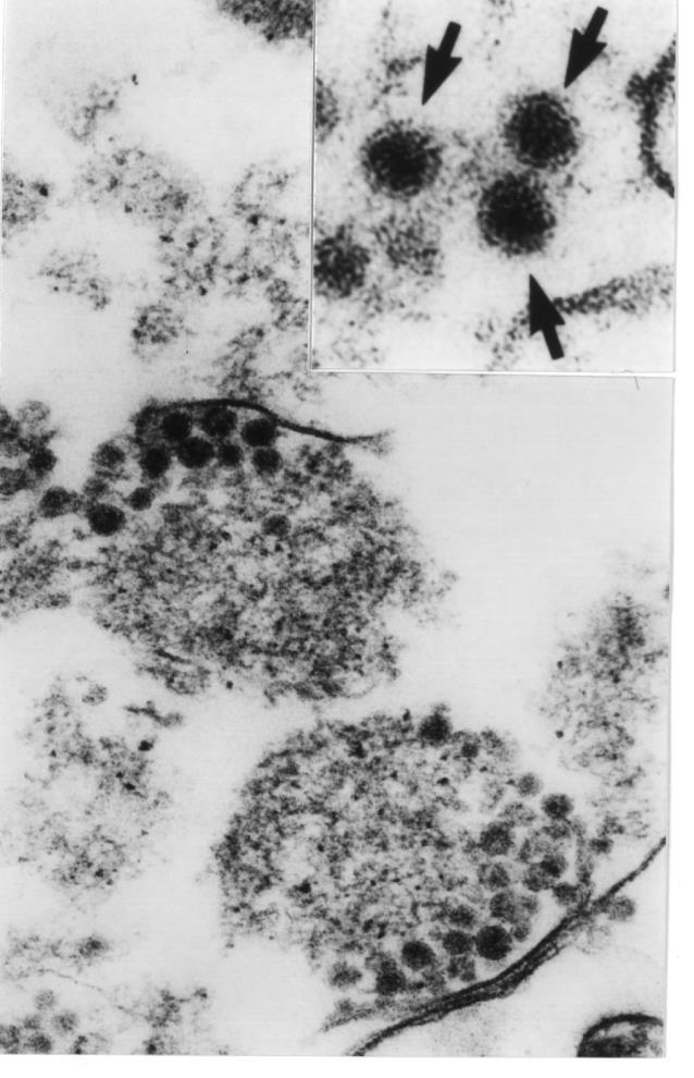 Hepatitis C Virus Shimizu et al., 1996 Positive single strand RNA virus Flaviviridae family, Hepacivirus genus 9.