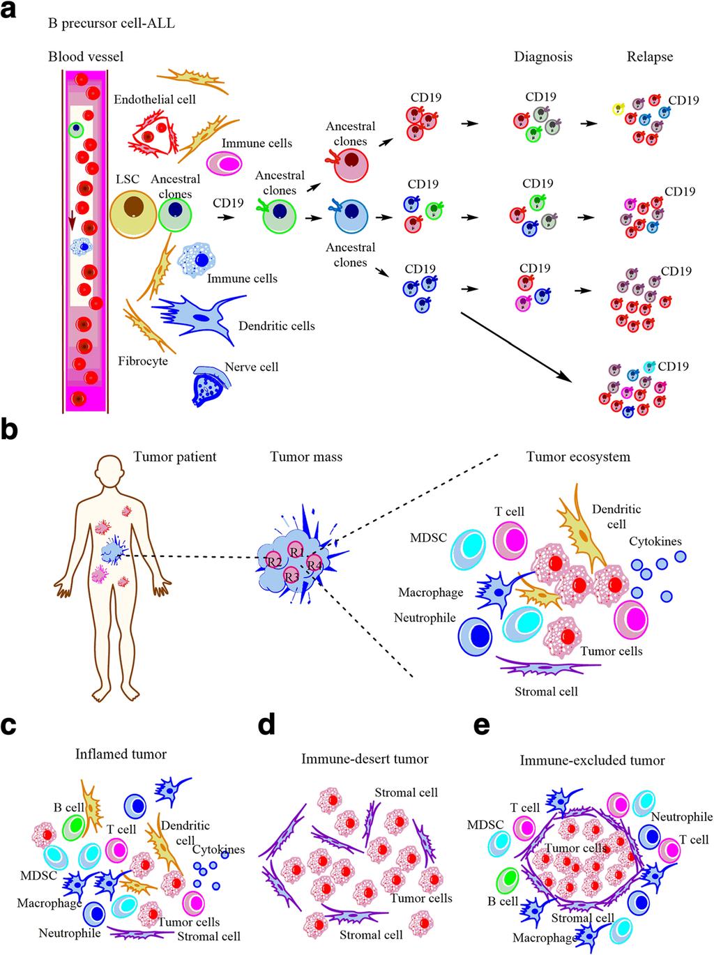 Ye et al. Molecular Cancer (2018) 17:32 Page 3 of 16 Fig. 1 Tumor ecosystem and cancer-immune phenotypes.