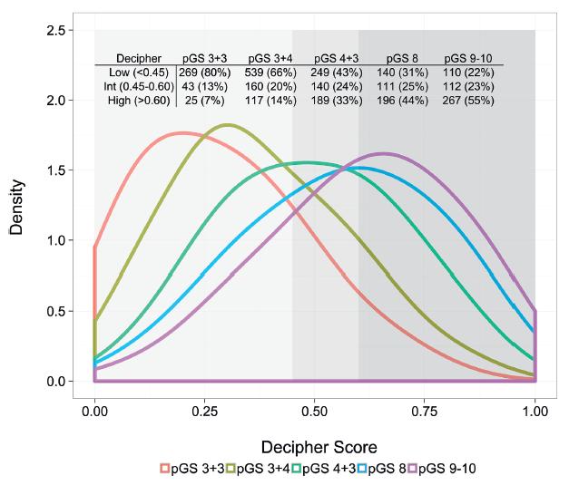 Genomic classifier for aggressive disease (Decipher metastasis scores) are elevated in a small but not insignificant proportion of pure GG1 tumors Tissue obtained from