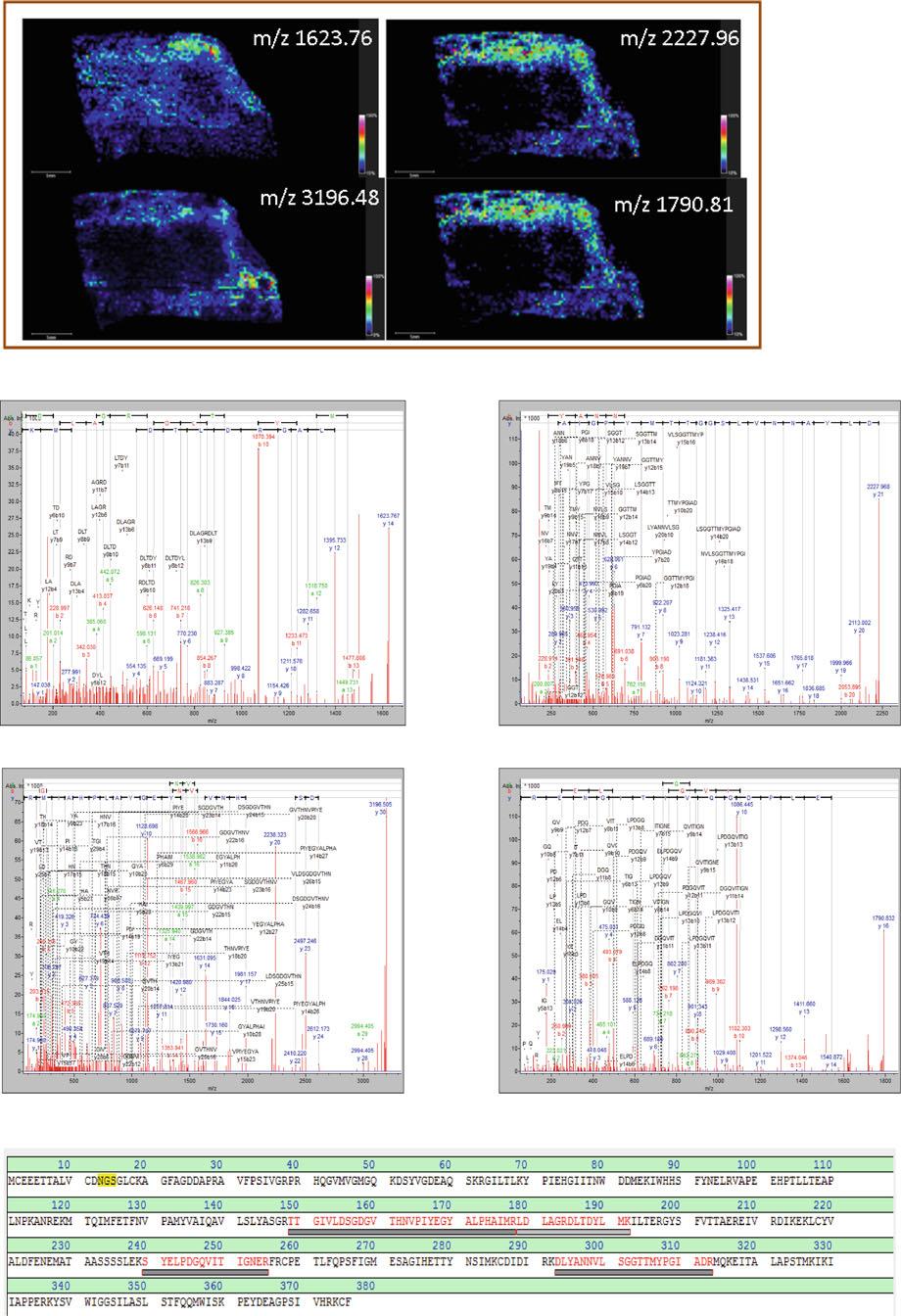 Multivariate analyses for biomarkers hunting and validation 161 [A] m/z 1623.