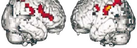 Any time an object is the target of an action, the parietal lobe is strongly activated.