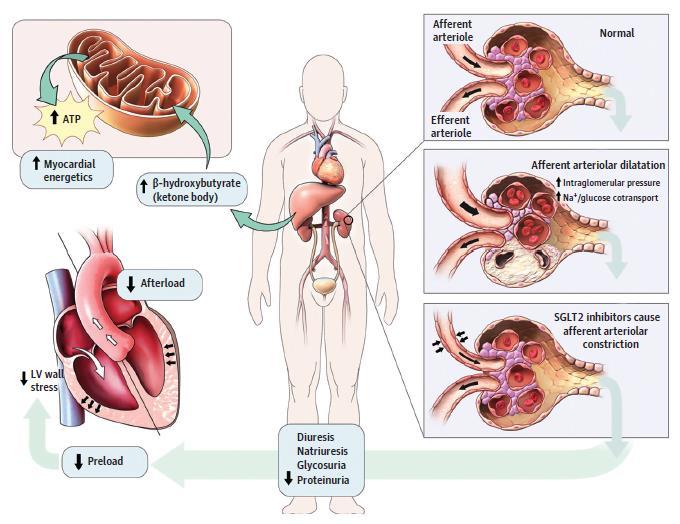 Proposed Mechanism of Cardiorenal Protection With