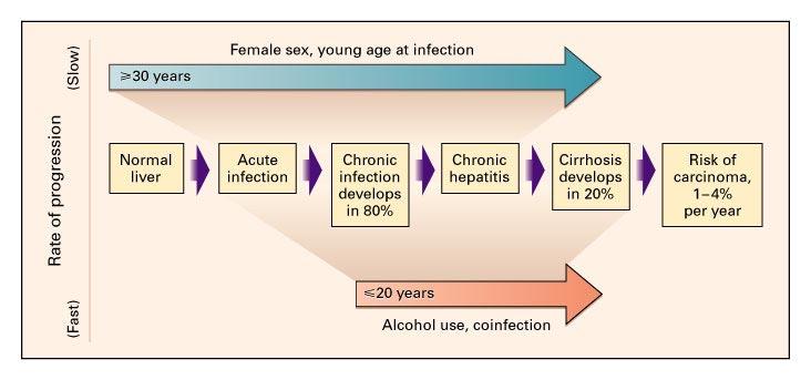 Natural Course HCV-Infection