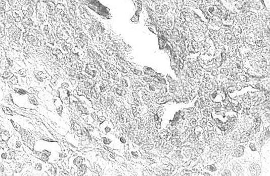 (C) Strong staining for Cu, Zn-superoxide dismutase is seen in normal transitional epithelial cells.