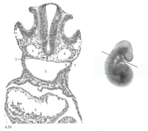 Cranial Nerve VIII Vestibulocochlear