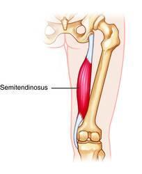 Origin: Ischial tuberosity Insertion: Semitendinosus (Part of the hamstrings) Prox/medial surface of