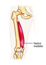 Vastus Medialis (part of Quadriceps) Origin: Medial lip of linea aspera; intertrochanteric line of the femur Insertion: Tibial