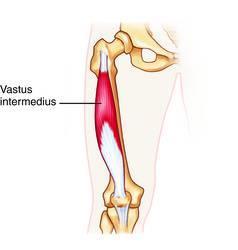 Origin: Vastus Intermedius (part of the Quadriceps) Upper 2/3 anterior shaft of femur