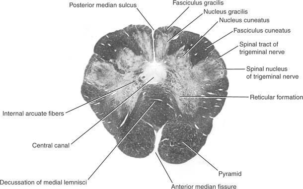 Transverse section of the medulla oblongata at