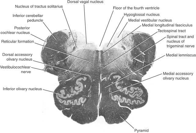 Transverse section of the medulla oblongata