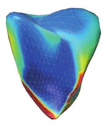 c Representative 3D endocardial surface analysis of the right ventricle (RV; left panel) and left ventricle (LV; right panel).