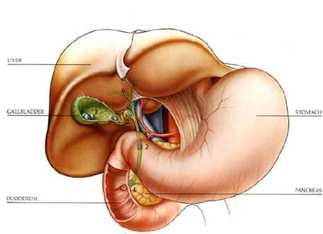 Gallstone development following gastric bypass can be prevented two ways. First, the gallbladder can be removed at the time of surgery. Second, one can take a medication called Actigall.
