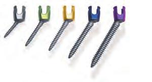 Thoracic Pedicle Screw placement may be performed in several ways according to surgeon experience and preference.