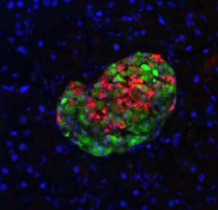 DPP-4 Inhibitor Restored Pancreatic Islet Beta Cells in