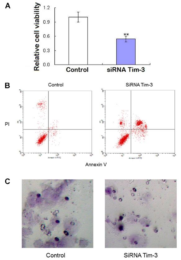 RT-PCR detection of Tim-3 mrna expression in osteosarcoma tissue.