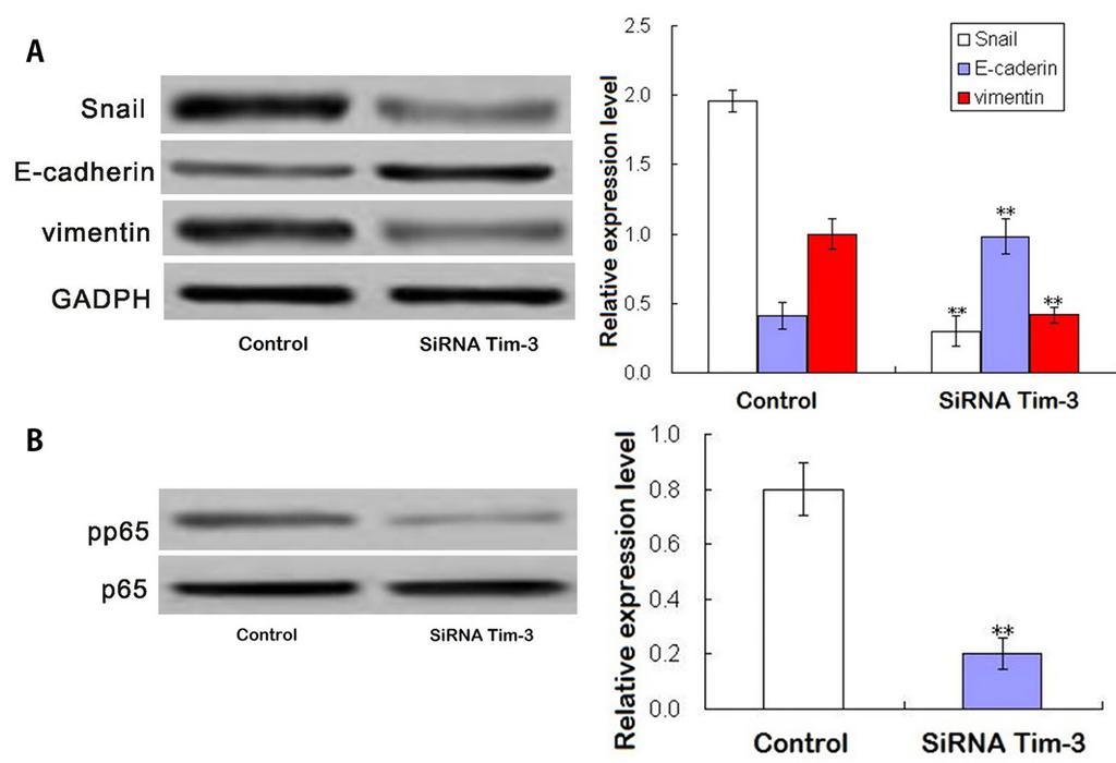 Z.M. Feng and S.M. Guo 6 Effect of Tim-3 on EMT and NF-κB activity in MG-63 cells Western blot analysis of Tim-3 sirna-transfected MG-63 cells showed a significant decrease in Snail and vimentin